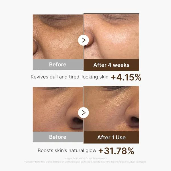 [Medicube] Deep Vita C Capsule Serum 30ml - Image 6