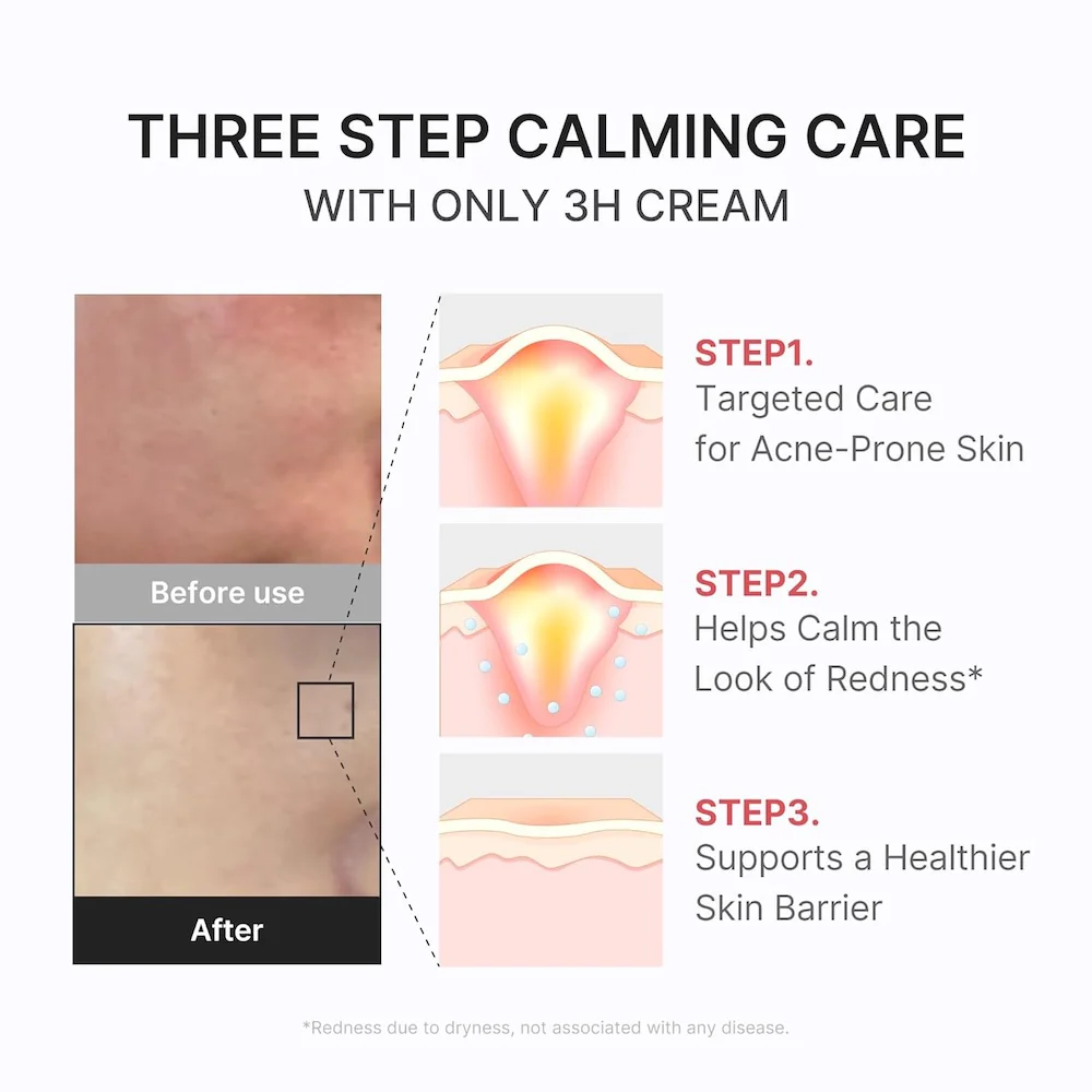 [Medicube] Hypochlorous 3H Relief Cream 50ml - Image 6