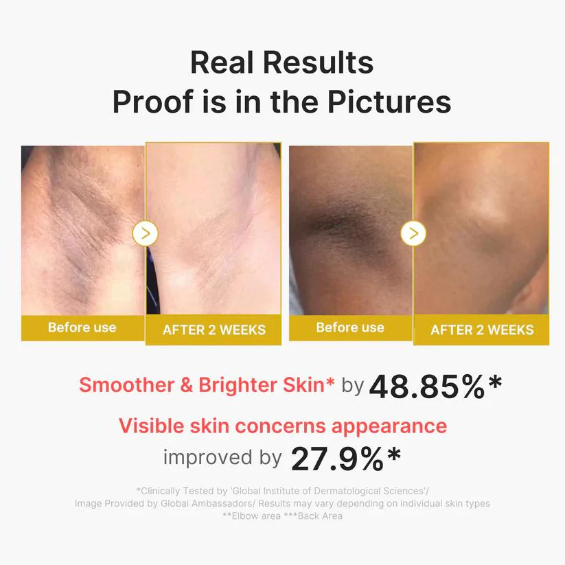 [Medicube] Kojic Acid Turmeric Body Peel Shot 280ml - Image 5