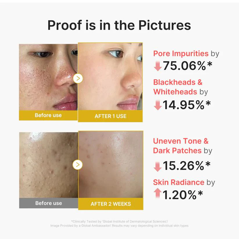 [Medicube] Kojic Acid Turmeric Peel Shot 80ml - Image 4