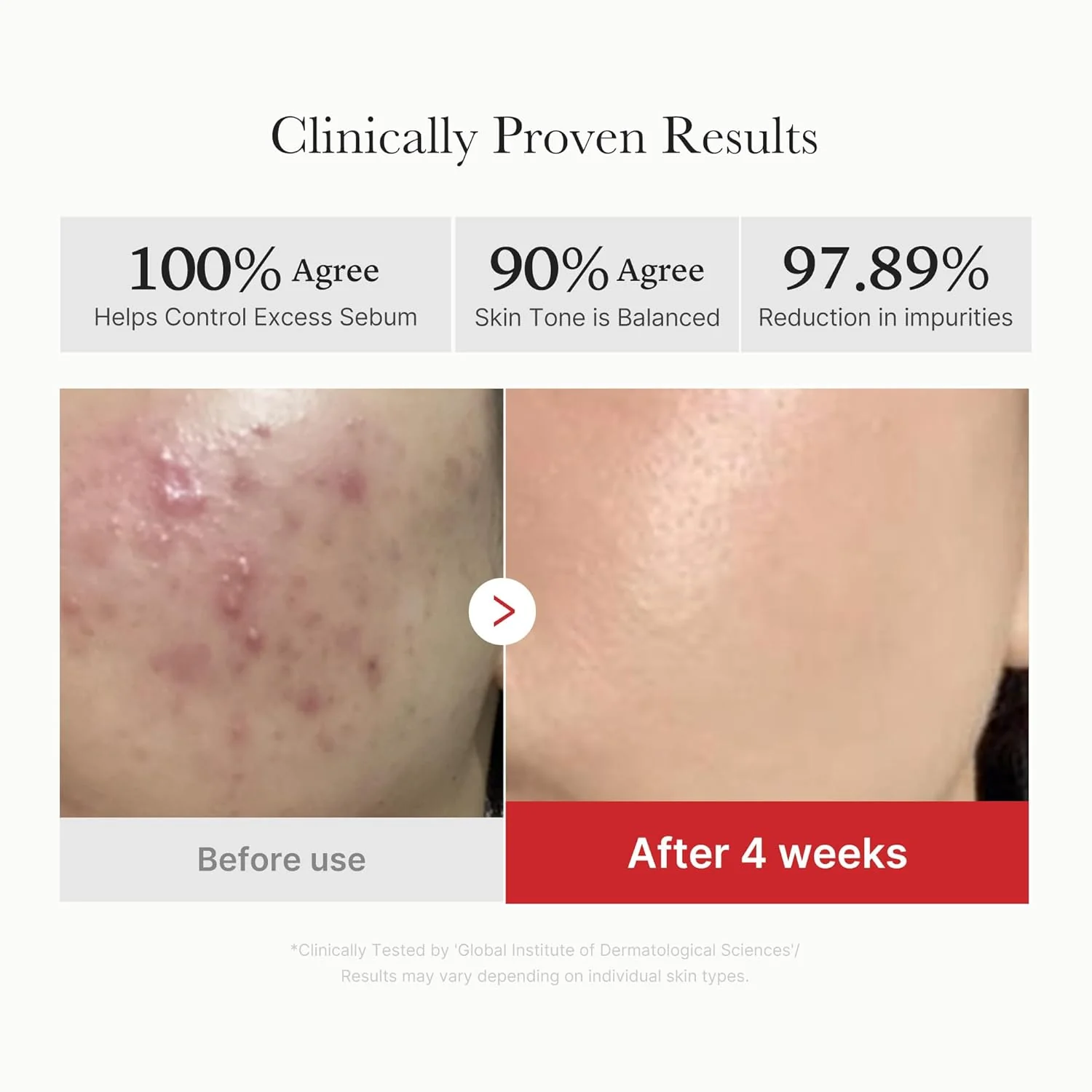 [Medicube] Discos Exfoliantes con Ácido Succínico Rojo 70 unidades - Image 4