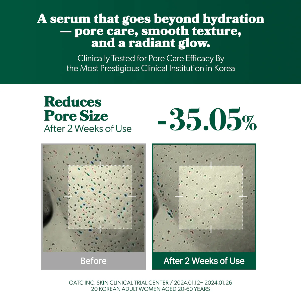 [Omitted] Fresh Lime Glow & Pore Refining Serum 50ml - Image 5