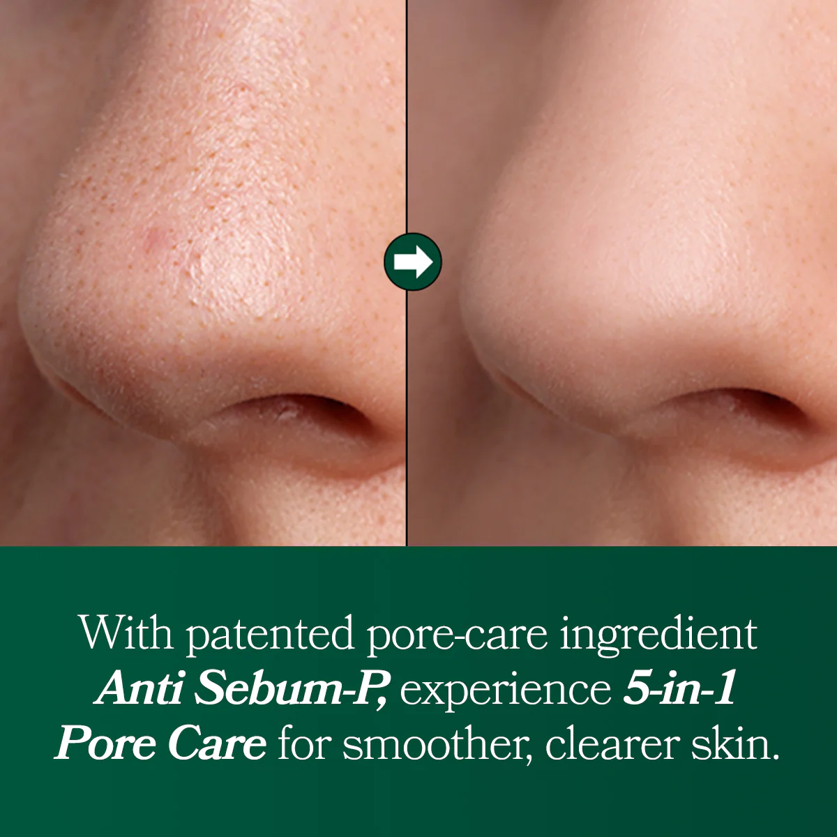 [Omitted] Fresh Lime Glow & Pore Refining Serum 50ml - Image 8