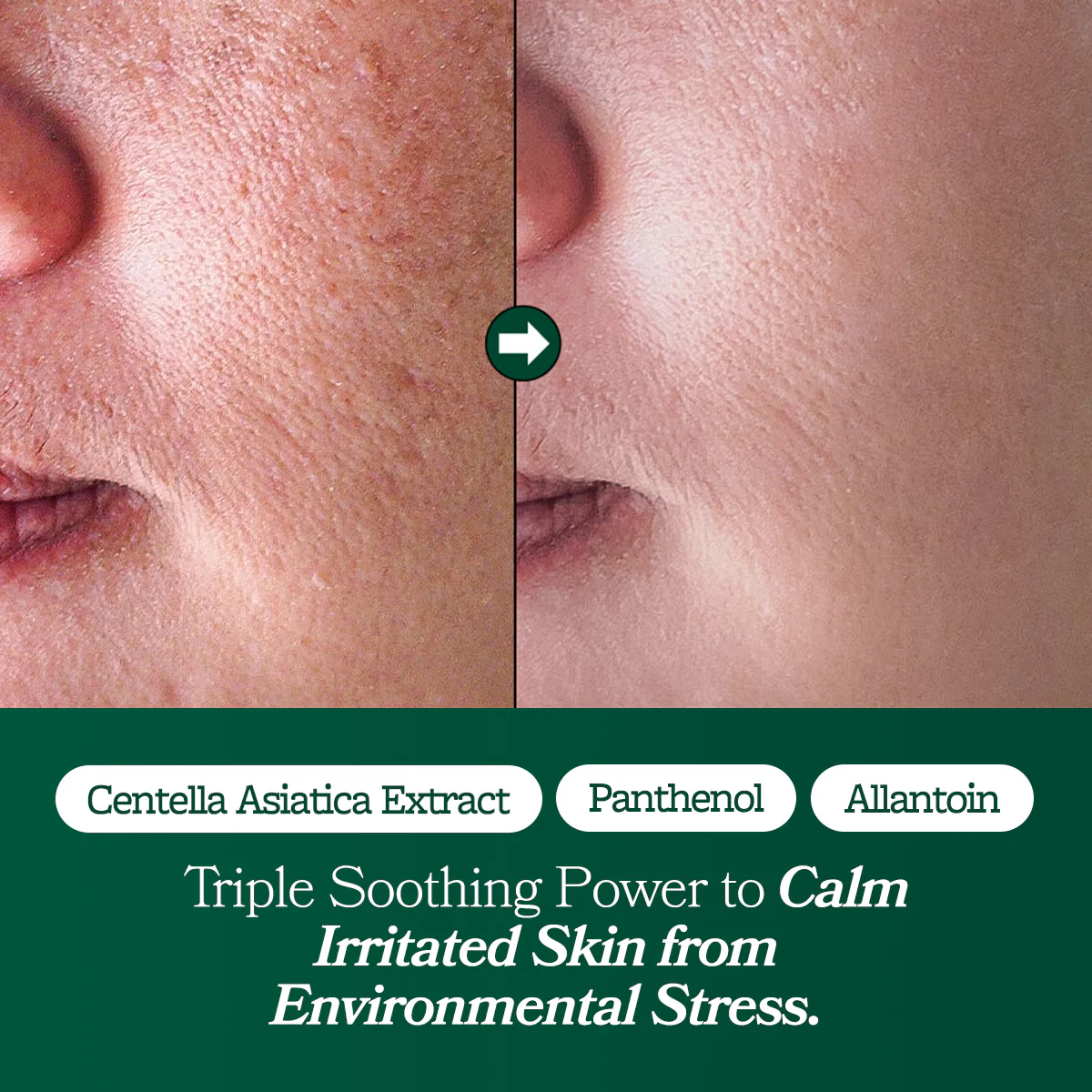 [Omitted] Fresh Lime Glow & Super Hydrating Moisturizer 80ml - Image 10