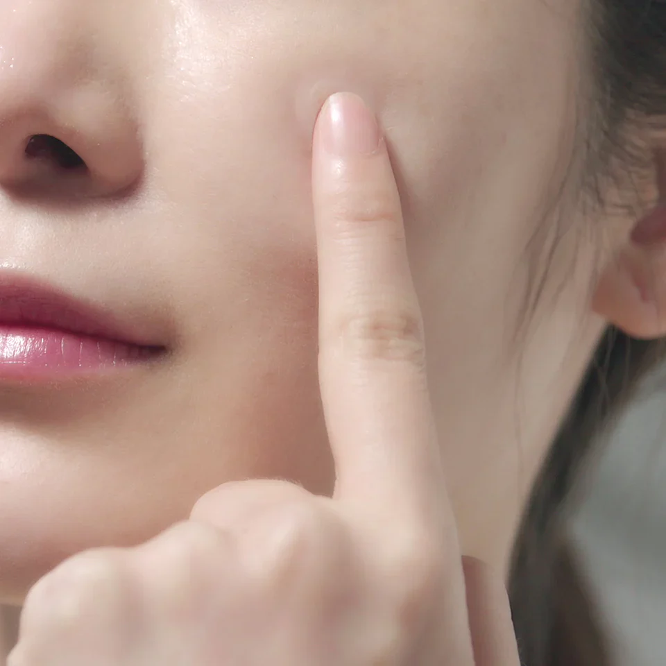 [PyunkangYul] Calming Clear Spot Patch (Intensive Care) 165ea - Image 3