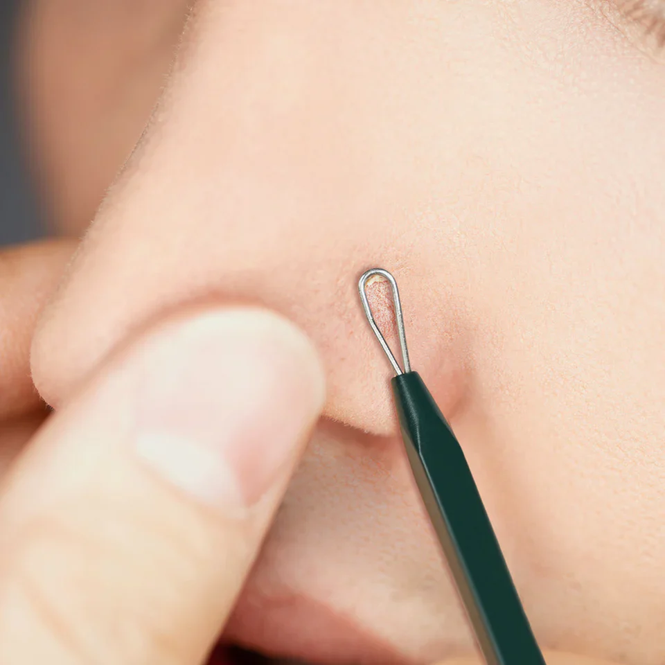 [PyunkangYul] Pimple Extractor - Image 3